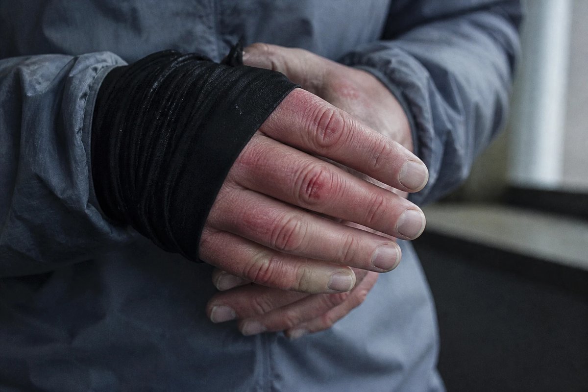 Nahaufnahme kalter, geröteter Hände nach einem Winterlauf, die Fingerspitzen wirken blass, die Hände werden zum Wärmen aneinandergelegt
